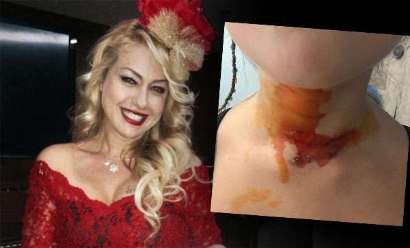 Yeliz Yeşilmen’in kızını kızgın yağ ile yaktılar!. galerisi resim 2