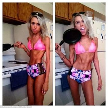 25 KİLO VE ÖLMEK ÜZEREYDİ! ŞİMDİKİ HALİ İSE... galerisi resim 1