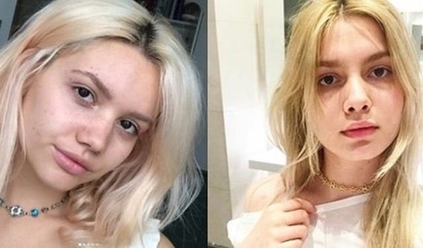 ALEYNA TİLKİ'YE ŞOK SUÇLAMA! galerisi resim 6