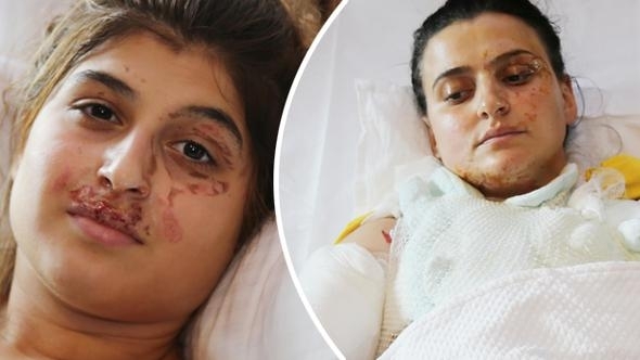 ANNE VE KIZININ KAHVALTI KEYFİ BİR ANDA KÂBUSA DÖNDÜ! NEDENİ İSE HERKESİ galerisi resim 3