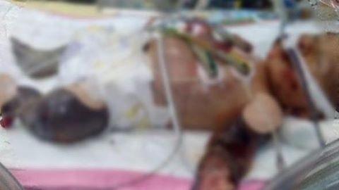 15 gün önce doğan bebek bu hale geldi! galerisi resim 1