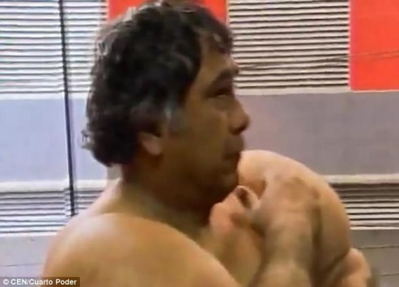 Balık Tutmak İçin Denize Girdi Ve... Vücudunu Görünce Şok Oldu! galerisi resim 11