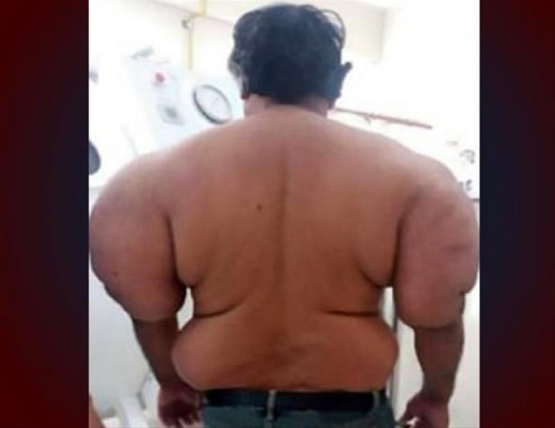 Balık Tutmak İçin Denize Girdi Ve... Vücudunu Görünce Şok Oldu! galerisi resim 2