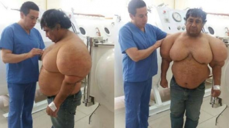 Balık Tutmak İçin Denize Girdi Ve... Vücudunu Görünce Şok Oldu! galerisi resim 5