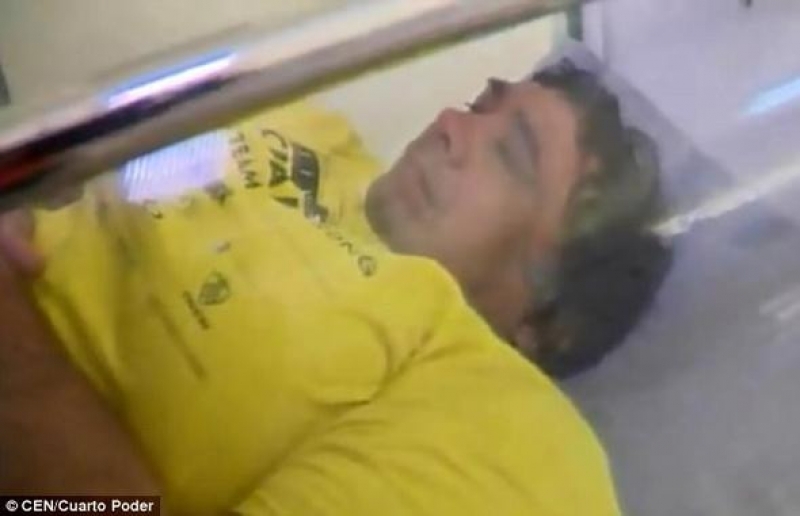 Balık Tutmak İçin Denize Girdi Ve... Vücudunu Görünce Şok Oldu! galerisi resim 6