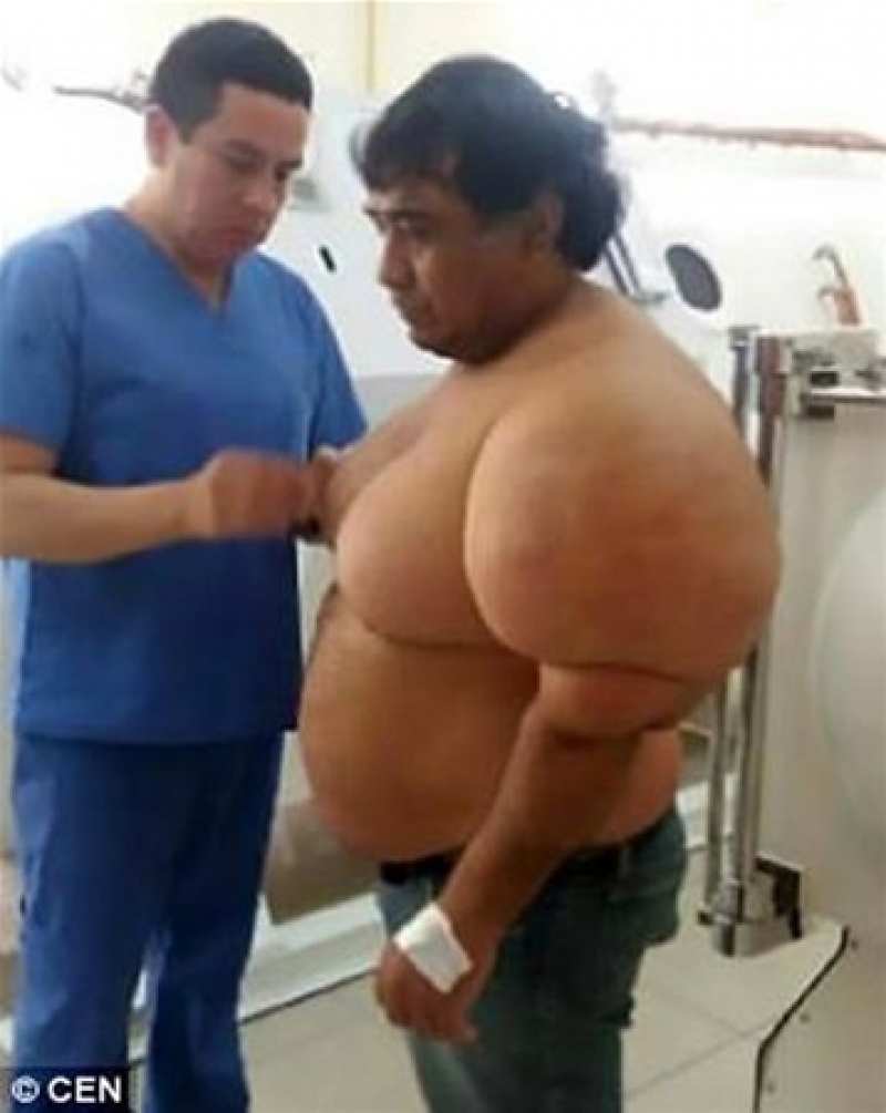 Balık Tutmak İçin Denize Girdi Ve... Vücudunu Görünce Şok Oldu! galerisi resim 9