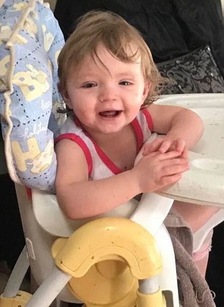 Vicdansız anne bebeğini kendi elleriyle bu hale getirdi sonrası korkunç galerisi resim 11