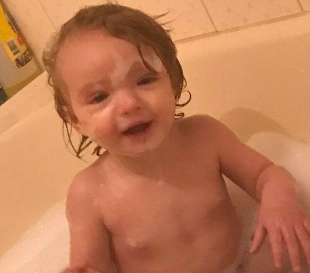 Vicdansız anne bebeğini kendi elleriyle bu hale getirdi sonrası korkunç galerisi resim 9