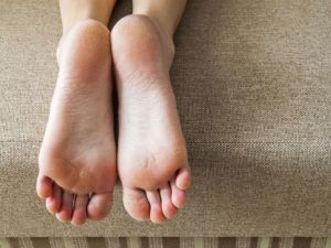 AYAK ŞİŞLİĞİ DEYİP GEÇMEYİN! O HASTALIĞIN BELİRTİSİ