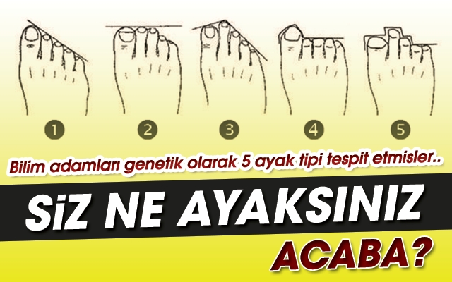 Sizin ayak tipiniz hangisi? Tıkla öğren..! galerisi resim 1
