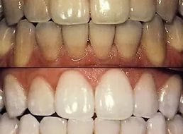 HAZIRLAMASI SADECE 2 DAKİKA SÜREN O MUCİZEVİ KARIŞIM! galerisi resim 4