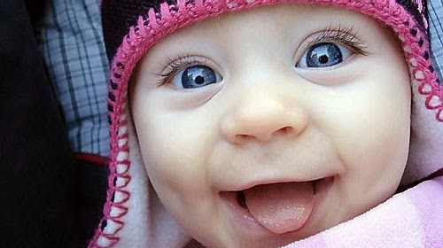 Dünyada 200 binde bir görülüyor Ankara’da doğdular galerisi resim 2