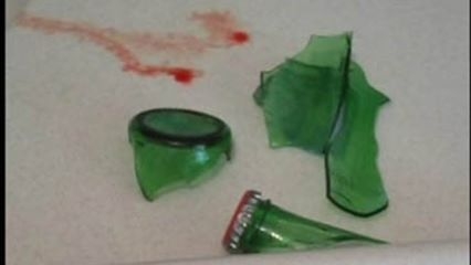 Bodrum katta soda şişeli işkence galerisi resim 2