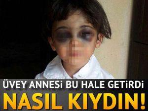 SKANDAL BUNU YAPAN İNSAN OLAMAZ!