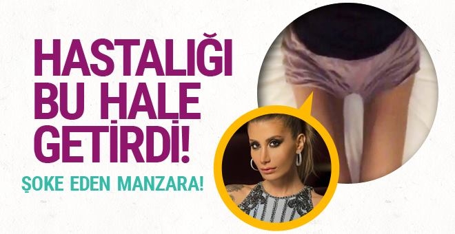 İrem Derici’nin hastalığı bu hale getirdi! Korkunç görüntü galerisi resim 5