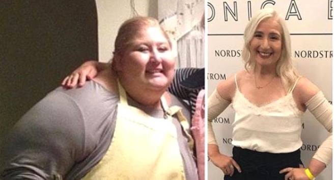 158 Kiloya İndi, Sarkan Derilerine Bakmadan Mayo Giydi galerisi resim 10