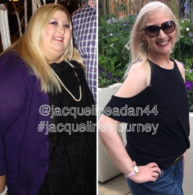 158 Kiloya İndi, Sarkan Derilerine Bakmadan Mayo Giydi galerisi resim 11