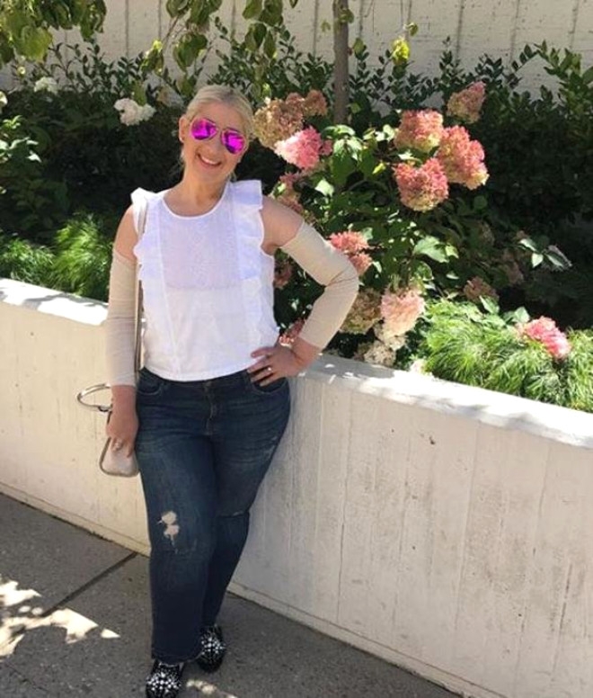 158 Kiloya İndi, Sarkan Derilerine Bakmadan Mayo Giydi galerisi resim 13