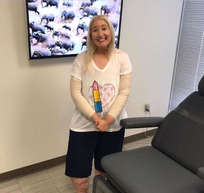 158 Kiloya İndi, Sarkan Derilerine Bakmadan Mayo Giydi galerisi resim 14