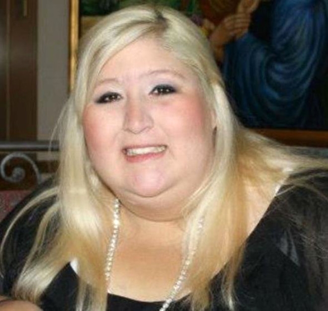 158 Kiloya İndi, Sarkan Derilerine Bakmadan Mayo Giydi galerisi resim 2