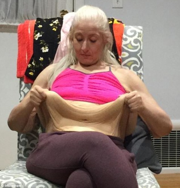 158 Kiloya İndi, Sarkan Derilerine Bakmadan Mayo Giydi galerisi resim 3