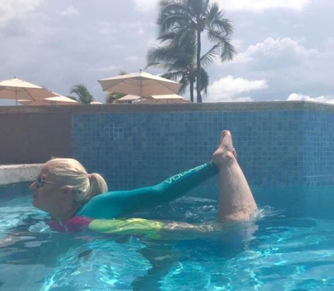 158 Kiloya İndi, Sarkan Derilerine Bakmadan Mayo Giydi galerisi resim 6