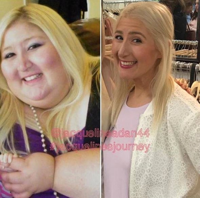 158 Kiloya İndi, Sarkan Derilerine Bakmadan Mayo Giydi galerisi resim 7