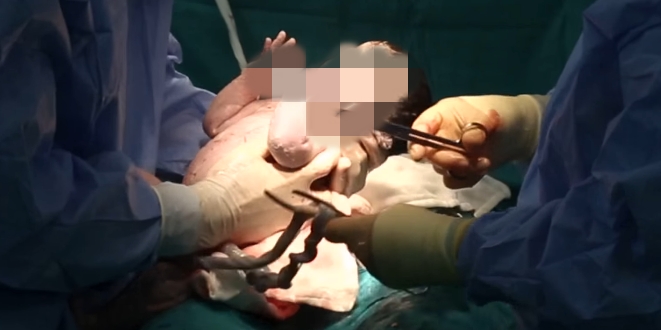 Genç Yaşta Olan Kız Kendinden Büyük Biri Evlenir ve! galerisi resim 3