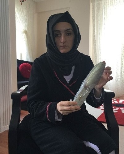 İçinden 25 santimetrelik cihaz çıktı galerisi resim 1