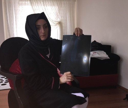 İçinden 25 santimetrelik cihaz çıktı galerisi resim 7