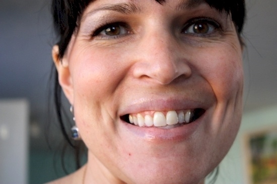 Sadece 5 Adımda Yüzünüzdeki Siyah Noktalardan Kurtulun.. İşte Çok Basit galerisi resim 4