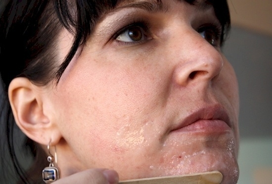 Sadece 5 Adımda Yüzünüzdeki Siyah Noktalardan Kurtulun.. İşte Çok Basit galerisi resim 5