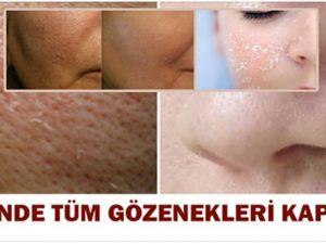 Genişlemiş Gözenekleri Baştan Sona Kapatacak Mucize Maske