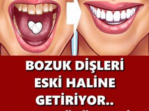 BOZUK DİŞLERİ ESKİ HALİNE GETİRİYOR, 40 YIL DÜŞÜNSENİZ AKLINIZA GELMEZ