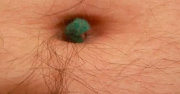 Göbek Deliğine Göre Kişilik Testi Sizinki Kaç Numara ? galerisi resim 8