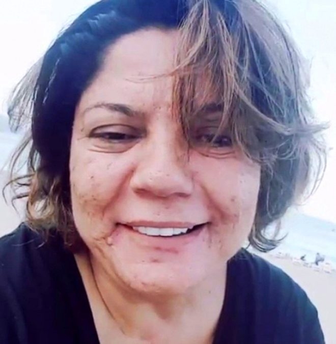 Son görüntüsüyle korkutmuştu! 15 kilo veren İzel,  d-ekoltesiyle büyüled galerisi resim 7