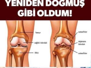 Diz ve eklem ağrılarını 3 günde kesen karışım Beş Günde Diz ve Eklem Ağr