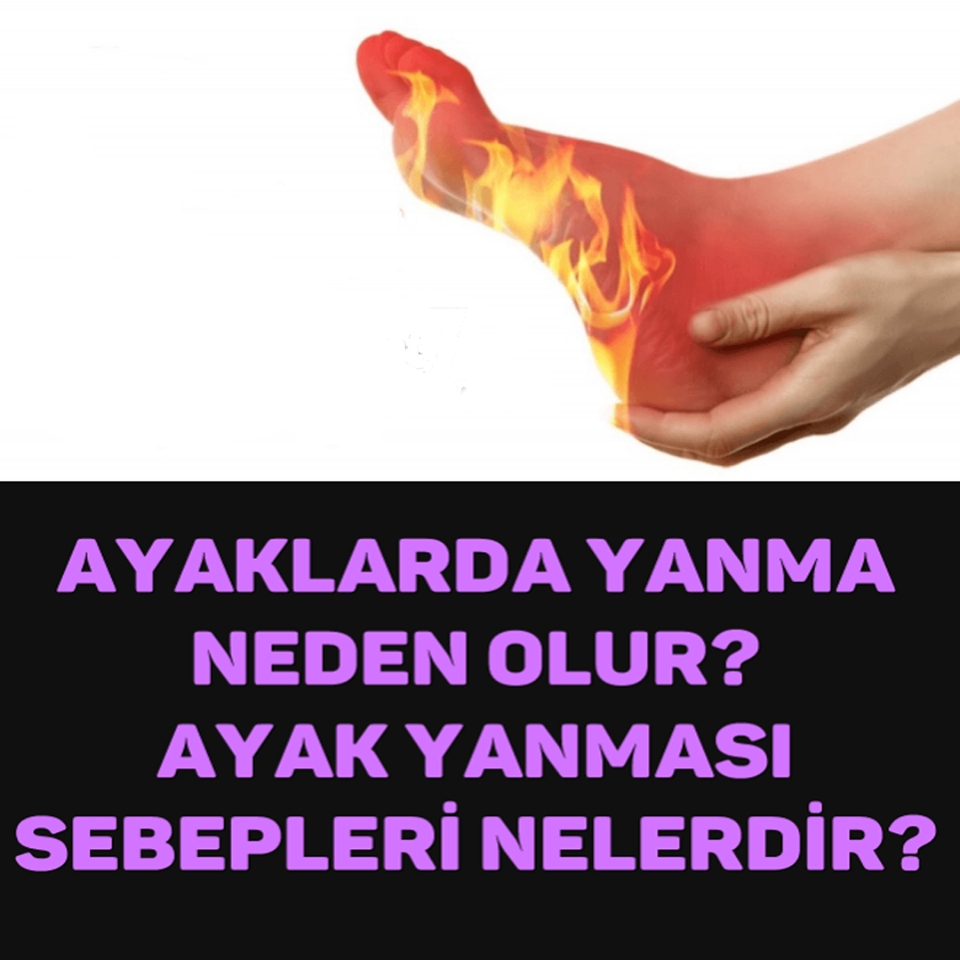 Ayaklarda Yanma Neden Olur – Ayak Yanmasının Sebepleri galerisi resim 1