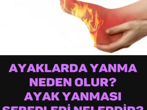Ayaklarda Yanma Neden Olur – Ayak Yanmasının Sebepleri