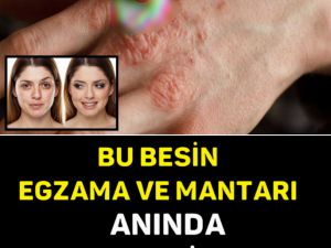 BU BESİN EGZAMA VE MANTARI ANINDA YOK EDİYOR