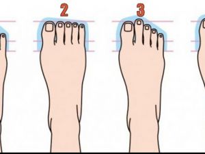 Ayak Tipi Bu Şekilde Olan Meğerse...