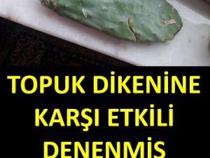 Topuk Dikeni Rahatsızlığına Karşı Doğal Yöntem