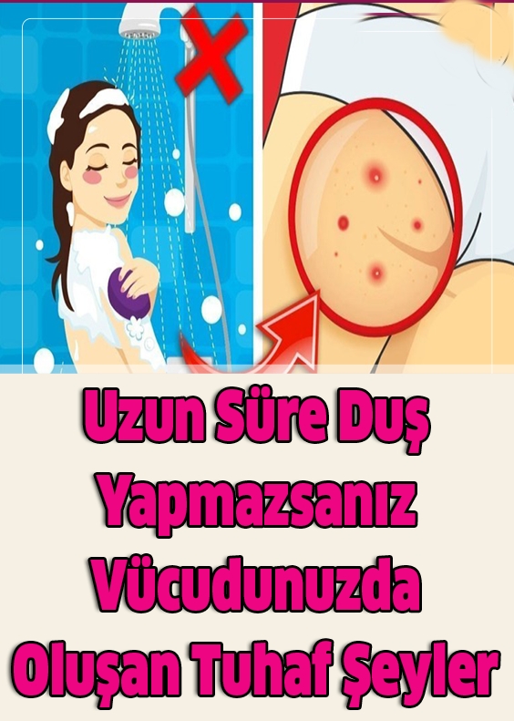Uzun Süre Duş Yapmazsanız Vücudunuzda Oluşan Tuhaf Şeyler galerisi resim 1
