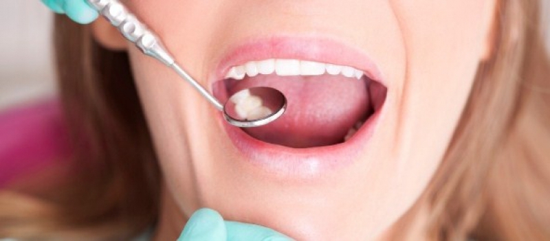 Çürük diş problemini ortadan kaldıran besin galerisi resim 1