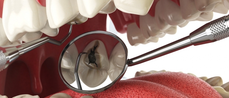 Çürük diş problemini ortadan kaldıran besin galerisi resim 5