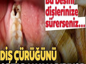 Çürük diş problemini ortadan kaldıran besin