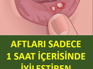 Aftları Sadece 1 Saat İçerisinde İyileştiren Doğal Çözüm.