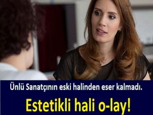 Ünlü Sanatçının eski halinden eser kalmadı. Estetikli hali o-lay! Bambaş