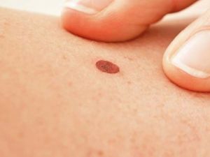 VUCUDUNDA BEN OLANLAR