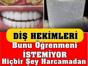 Evde Diş Beyazlatmanın Mucize Yöntemi
